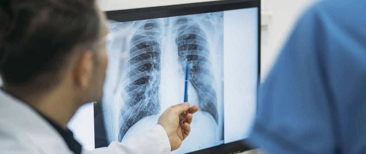 raio-x-de-torax.jpg